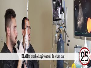 BEAH'ta bronkoskopi yöntemi ile erken tanı