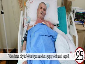 Çatıyı onarırken yüksek gerilime kapıldı
